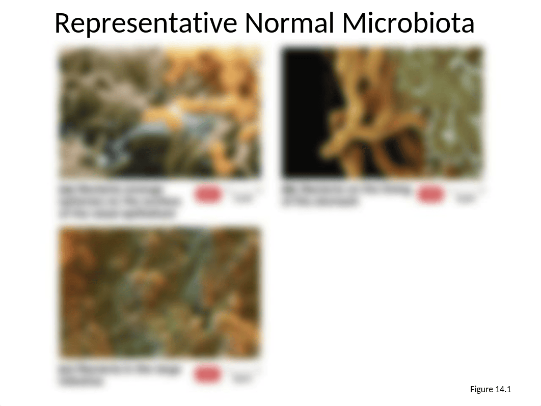 10Microbiology14.ppt_d4hbk3qk5k3_page5