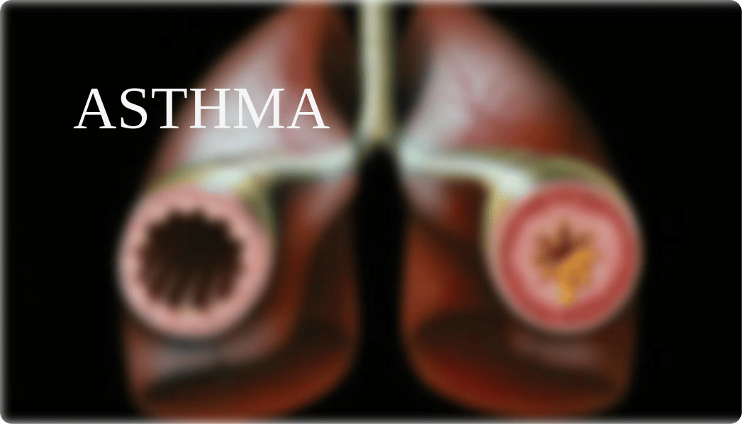 Asthma Presentation-5.pptx_d4j2n05115e_page1