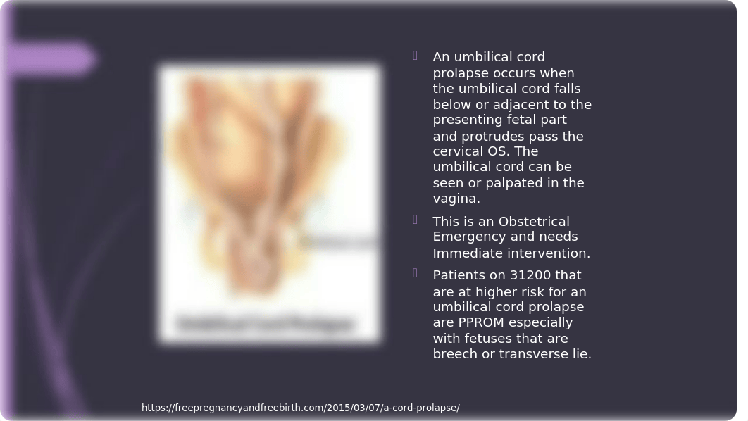 Umbilical Cord Prolapse.pptx_d4lqyebh38l_page2