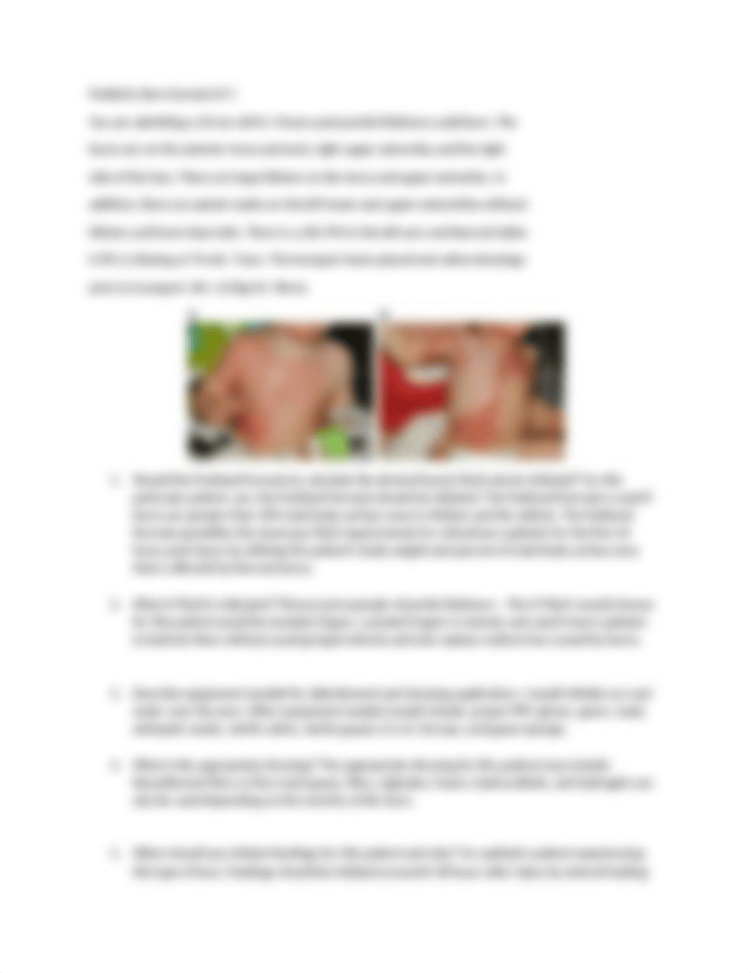 cbenoit_Pediatric Burn Scenario_8921.docx_d4qfv8fiymj_page1