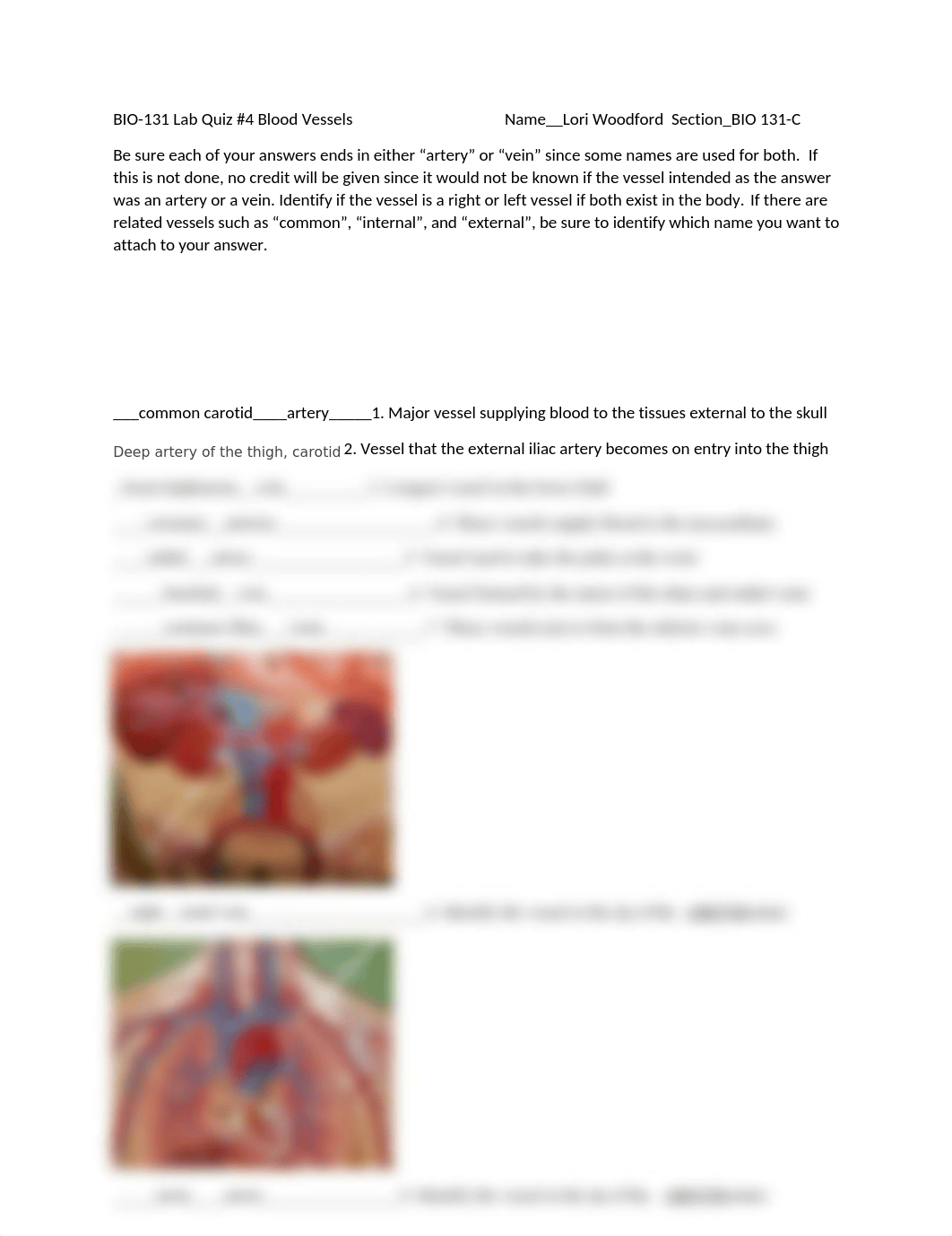 Lab Quiz #4 Blood Vessels 2021.docx_d4qj8etes3g_page1