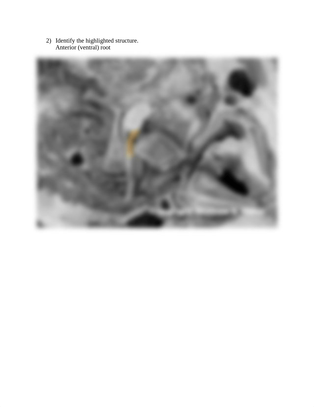 REAL_ANATOMY_LAB_12_spinal_cord_and_nerves_anatomy (1).docx_d4y6t2zwynb_page2