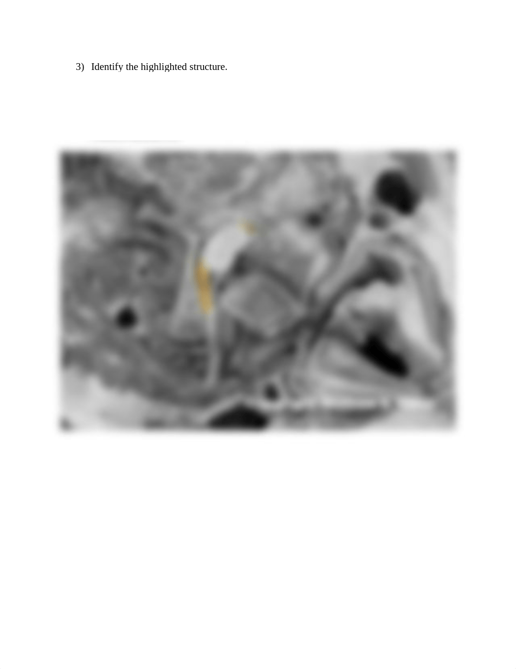 REAL_ANATOMY_LAB_12_spinal_cord_and_nerves_anatomy (1).docx_d4y6t2zwynb_page3