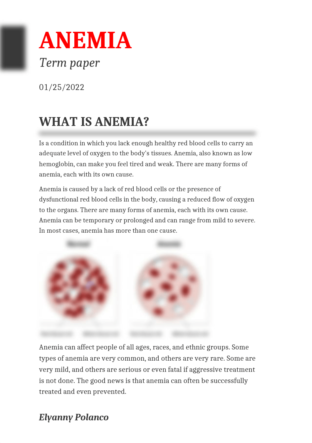 ANEMIA Term paper.docx_d51tqaya04h_page1