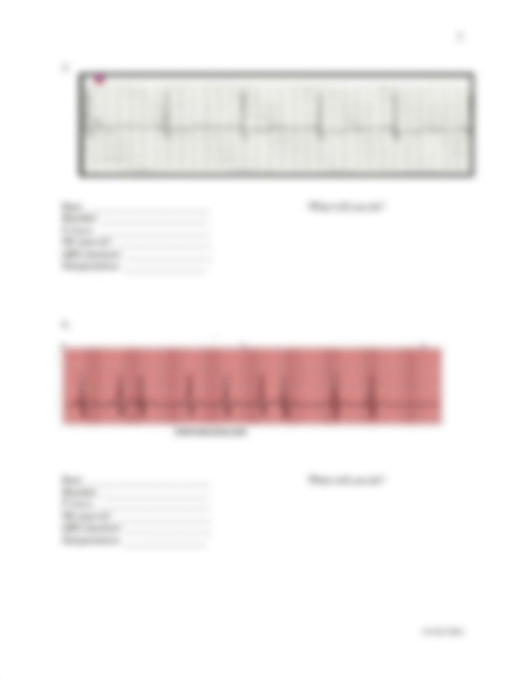 ECG Practice(1) (1).docx_d5479cag4cd_page3