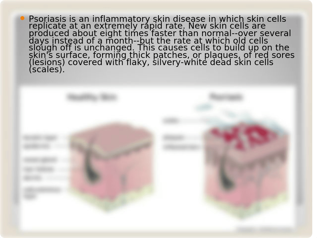 PSORIASIS.ppt_d55meuzh61b_page4