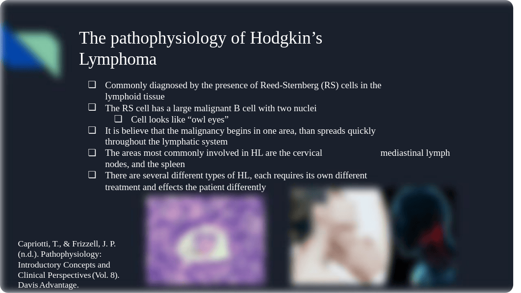 Hodgkin's Lymphoma PPT EZ.pptx_d59fr83vaax_page2