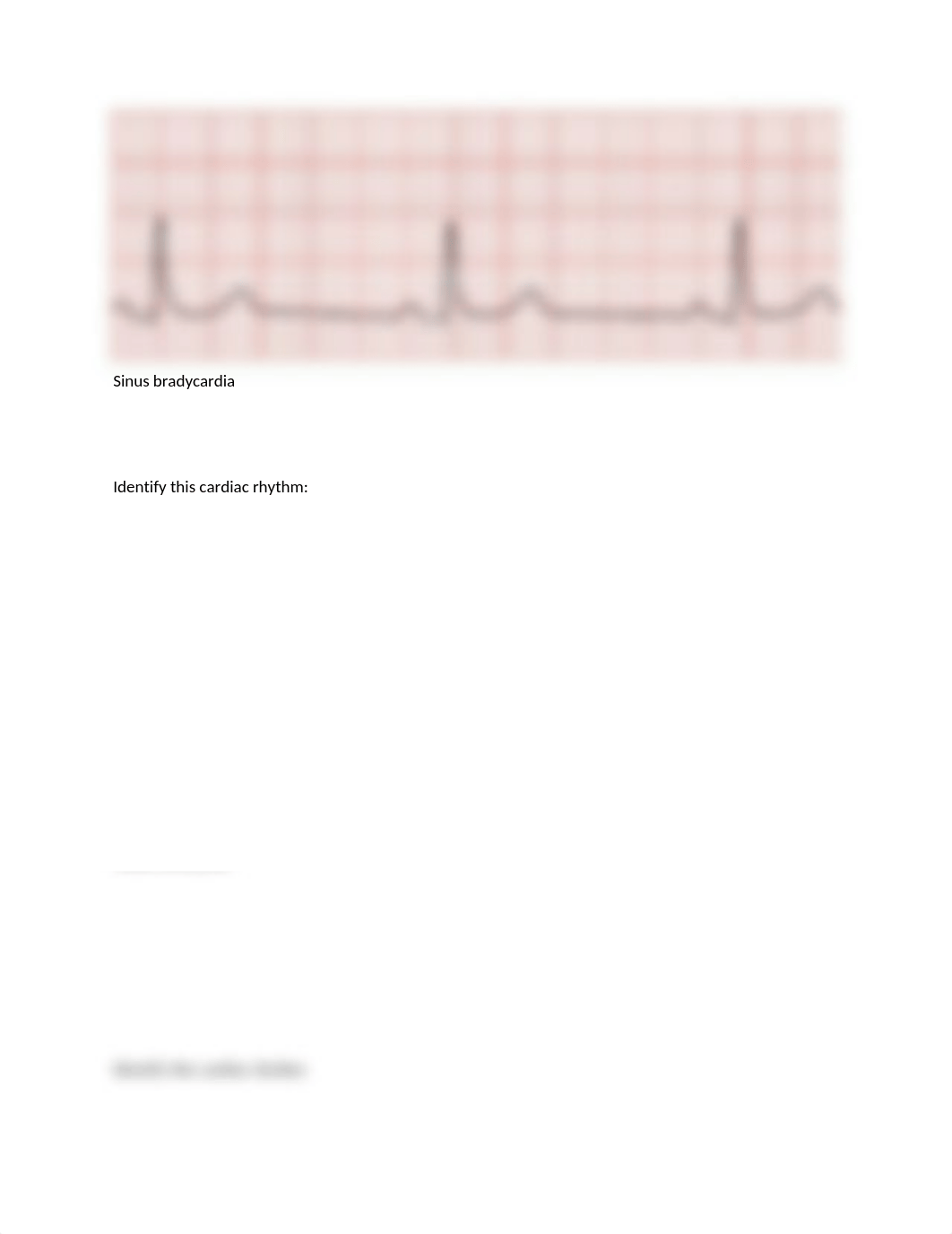 Cardiac rhythms 1 (Shannon R. Garrett).docx_d5a2s9p4cgr_page2