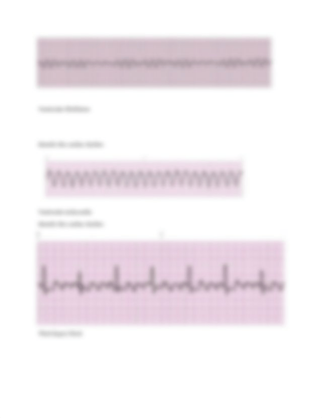 Cardiac rhythms 1 (Shannon R. Garrett).docx_d5a2s9p4cgr_page3