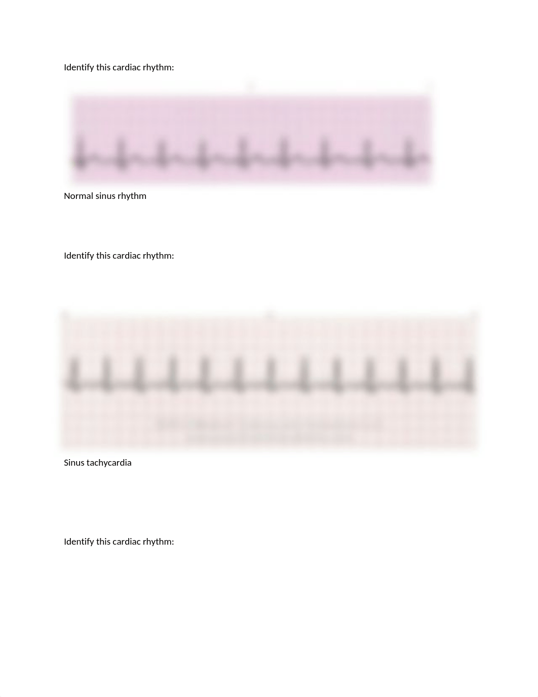 Cardiac rhythms 1 (Shannon R. Garrett).docx_d5a2s9p4cgr_page1