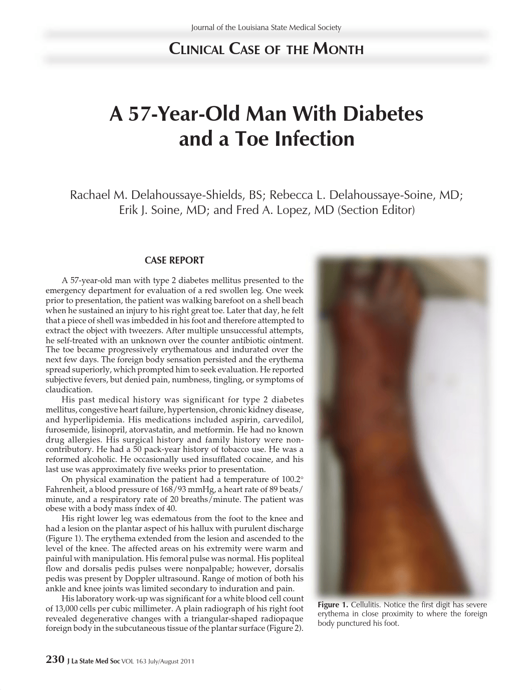 2011 Jul-Aug Clinical Case of the Month - A 57-Year-Old Man With Diabetes and a Toe Infection (1).pd_d5amxu93vl2_page1