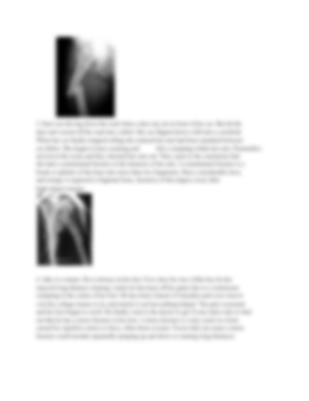 fracture case study  sheet.pdf_d5fn98xvu69_page2