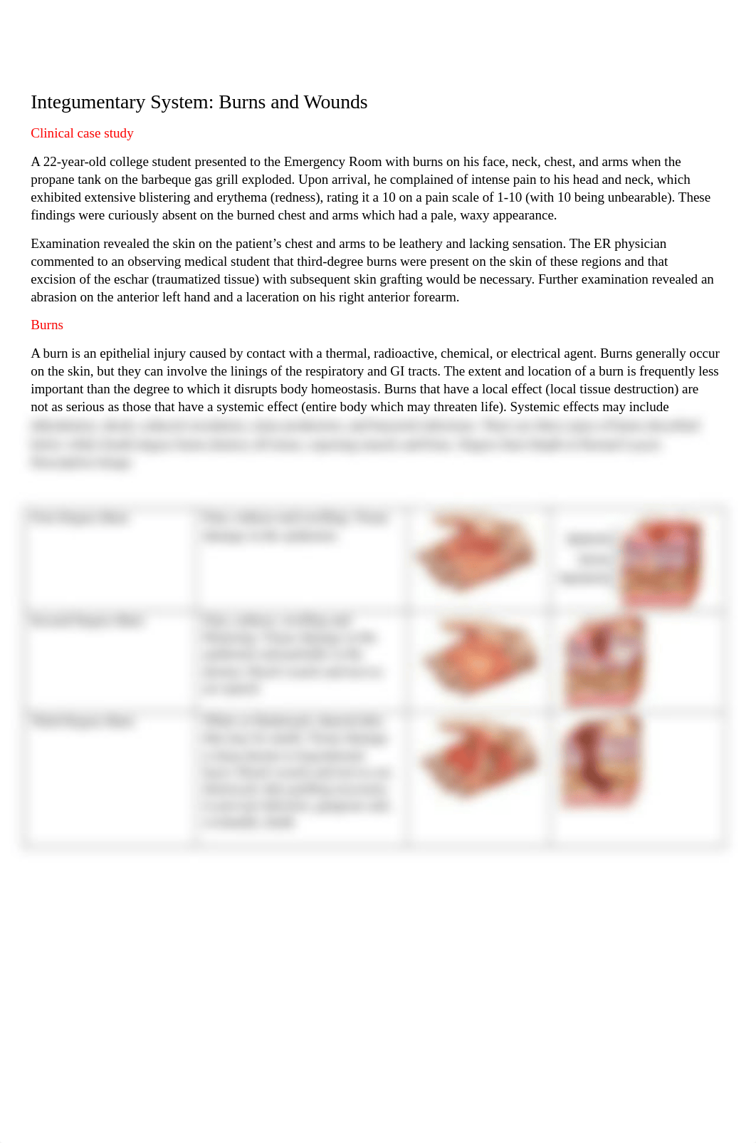 Wound and burn case study.docx_d5gcgw362j5_page1