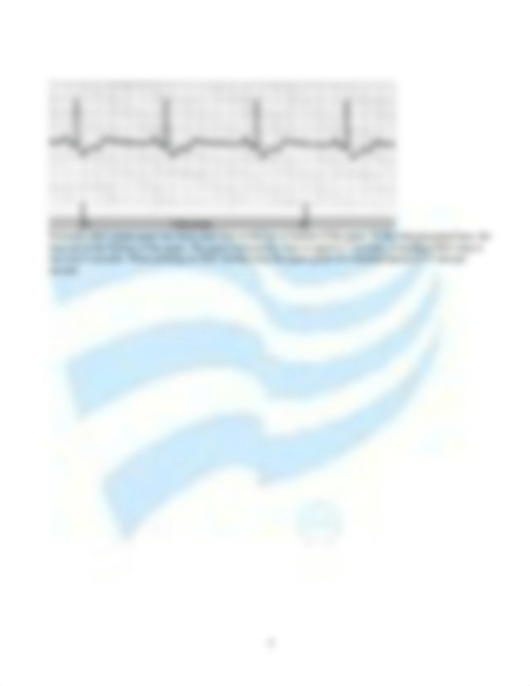 EKG StudyGuide.pdf_d5jx9u083td_page5