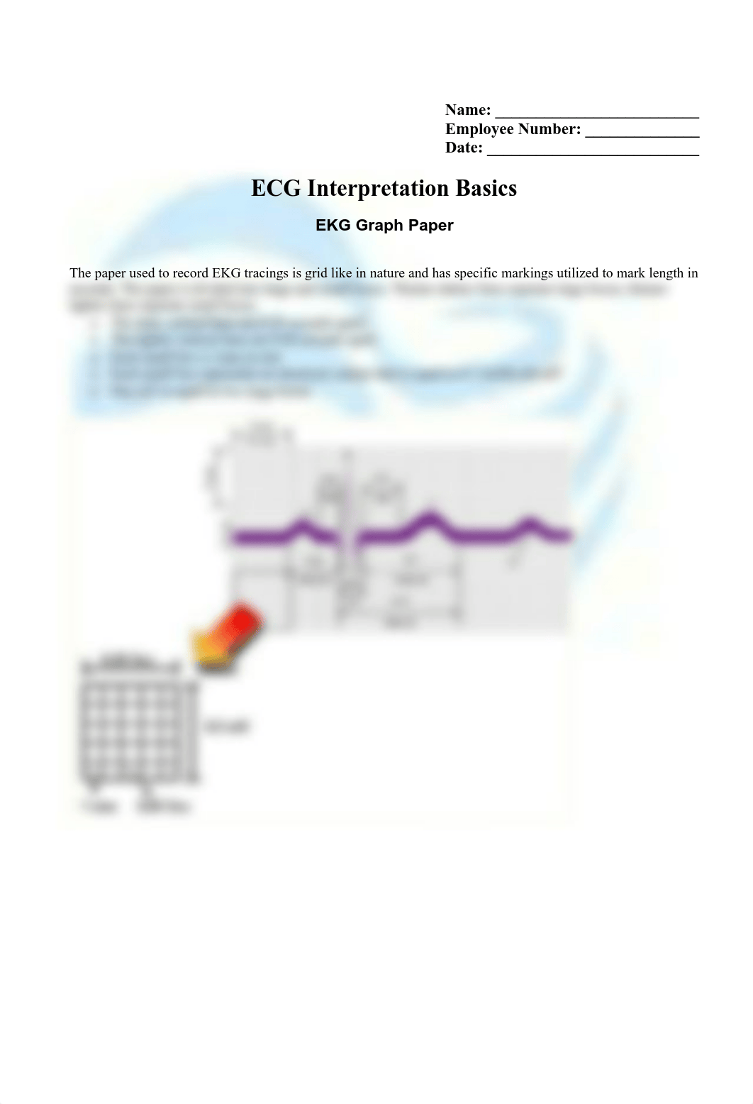 EKG StudyGuide.pdf_d5jx9u083td_page4