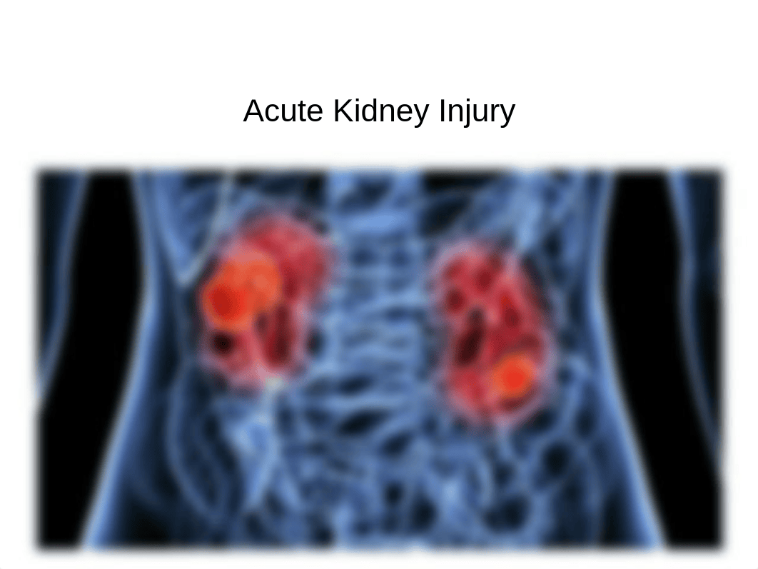 2019 Acute Kidney Injury.ppt_d5ny9dyol09_page1