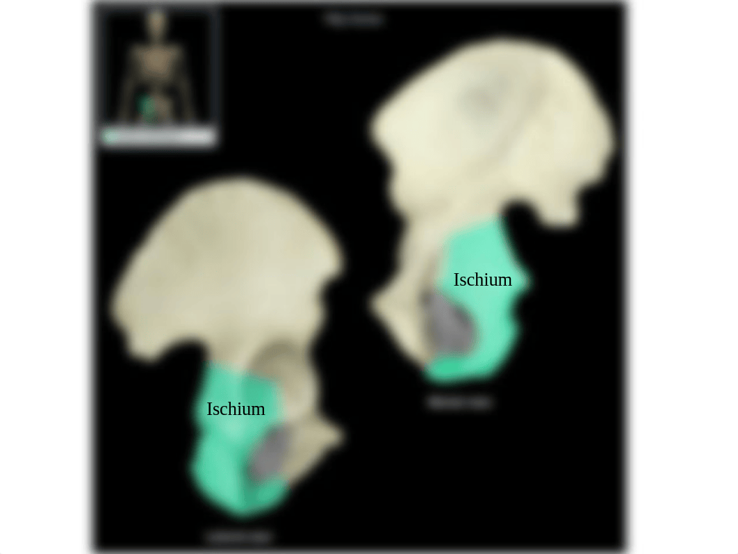 Bones_of_Pelvic_Girdle_and_Leg.pptx_d5pc7oppiyp_page5