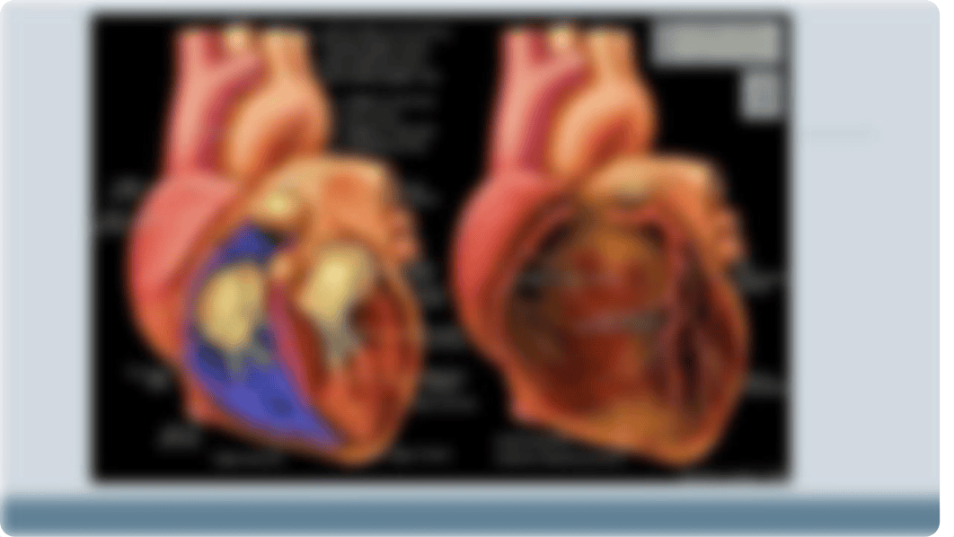 Cardiac PPT(2).pptx_d5qqfqhenag_page4