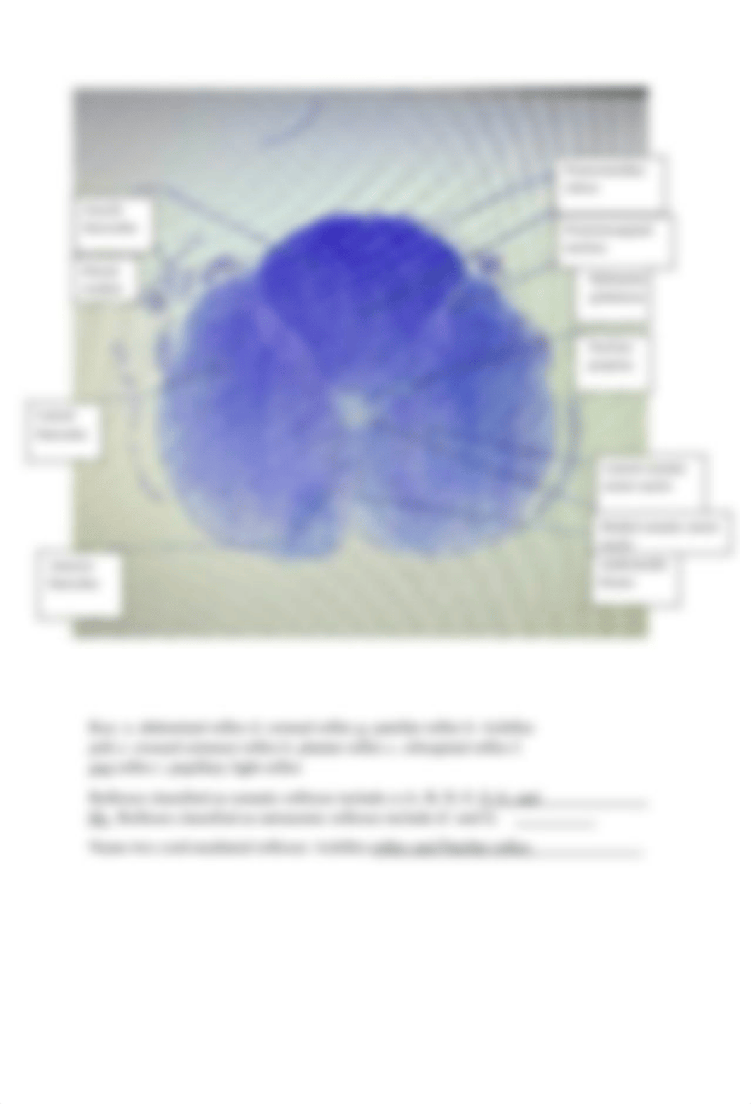 Spinal Cord Lab Work.docx_d5tj8r5pl3k_page4