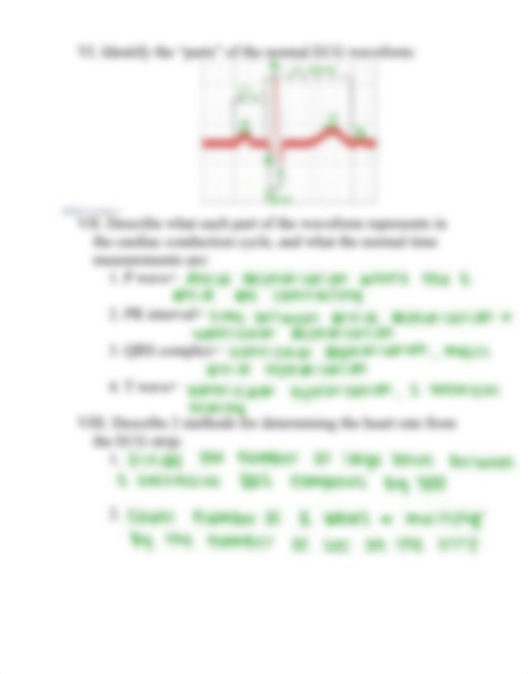 Dysrhythmia Worksheet.pdf_d5uh7wxkf7z_page2