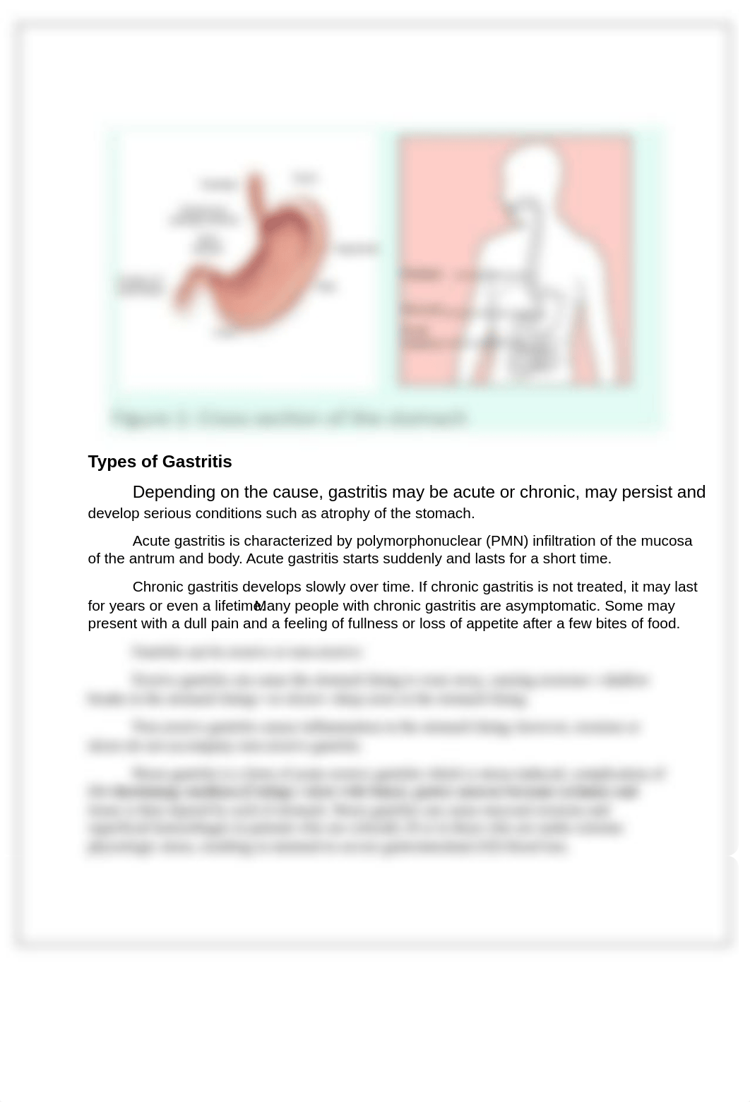 care-of-a-client-with-gastritis.pdf_d5w15iahse9_page2