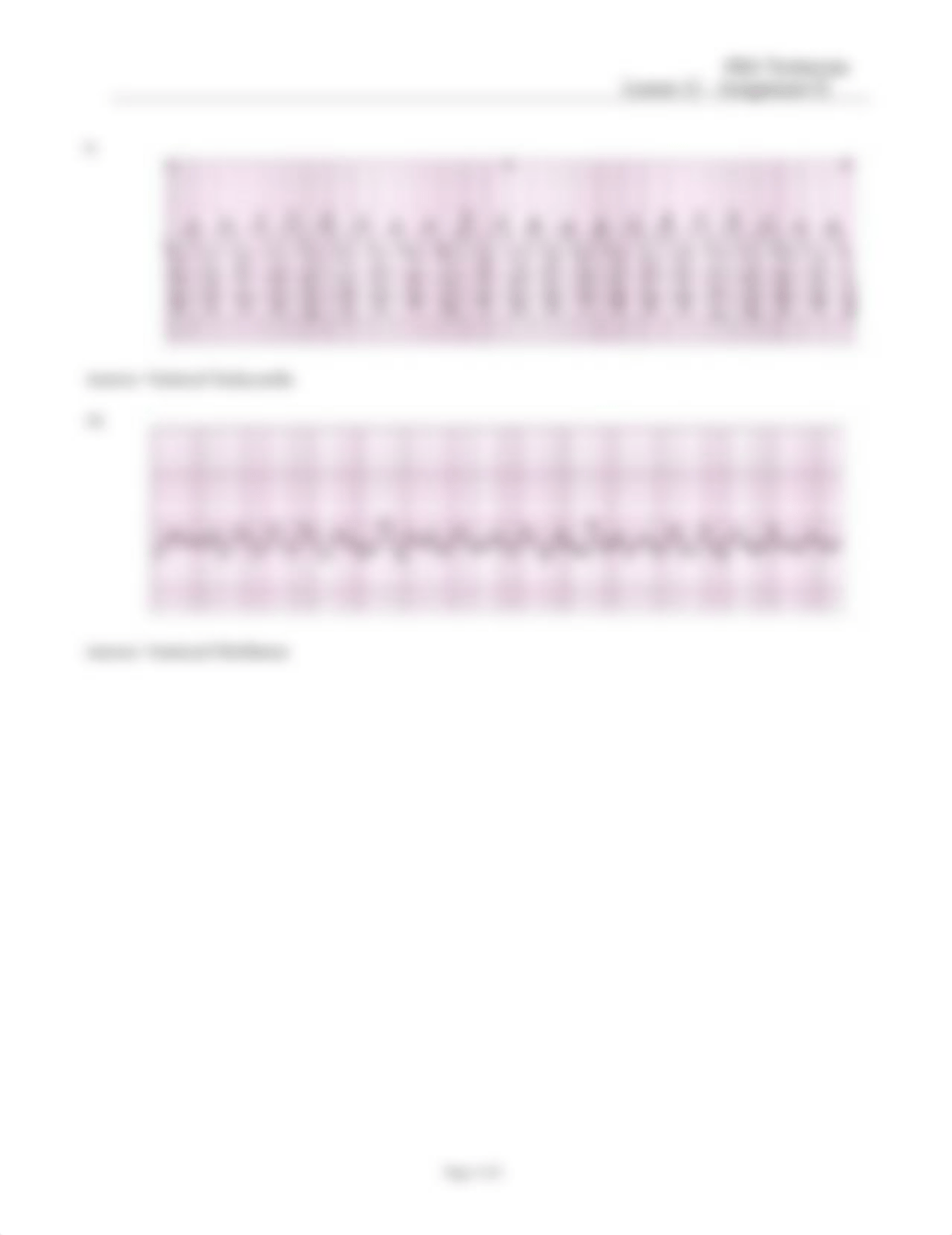 EKG Technician Lesson 12 Assignmen2 completed.doc_d5yxxec63nw_page5