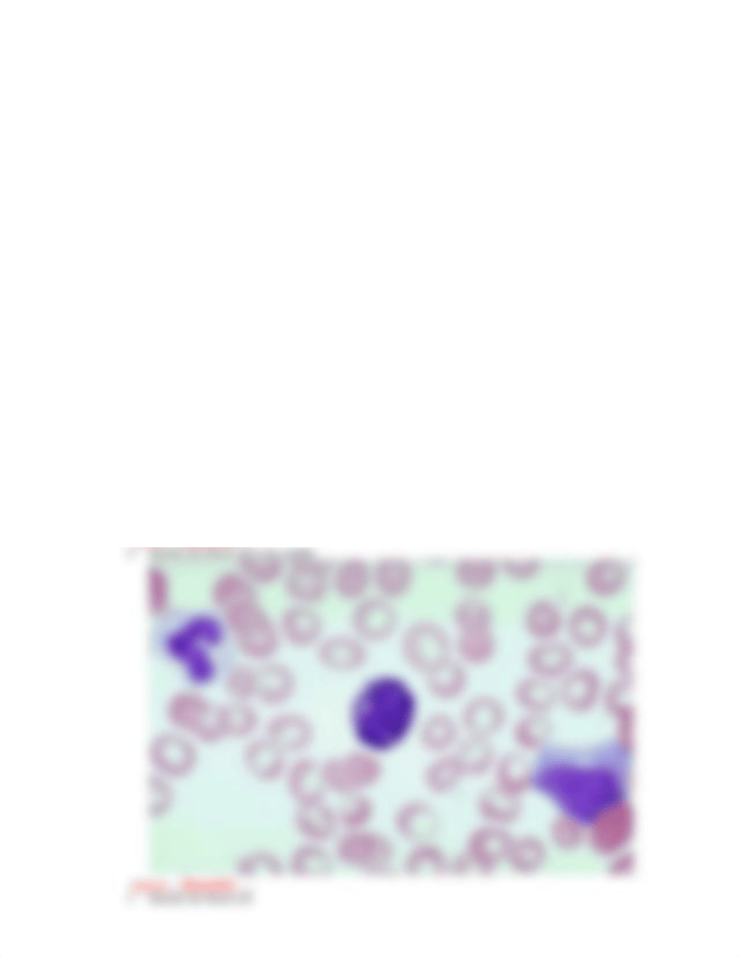 Identify the blood cell.docx_d61yuuhddpz_page2