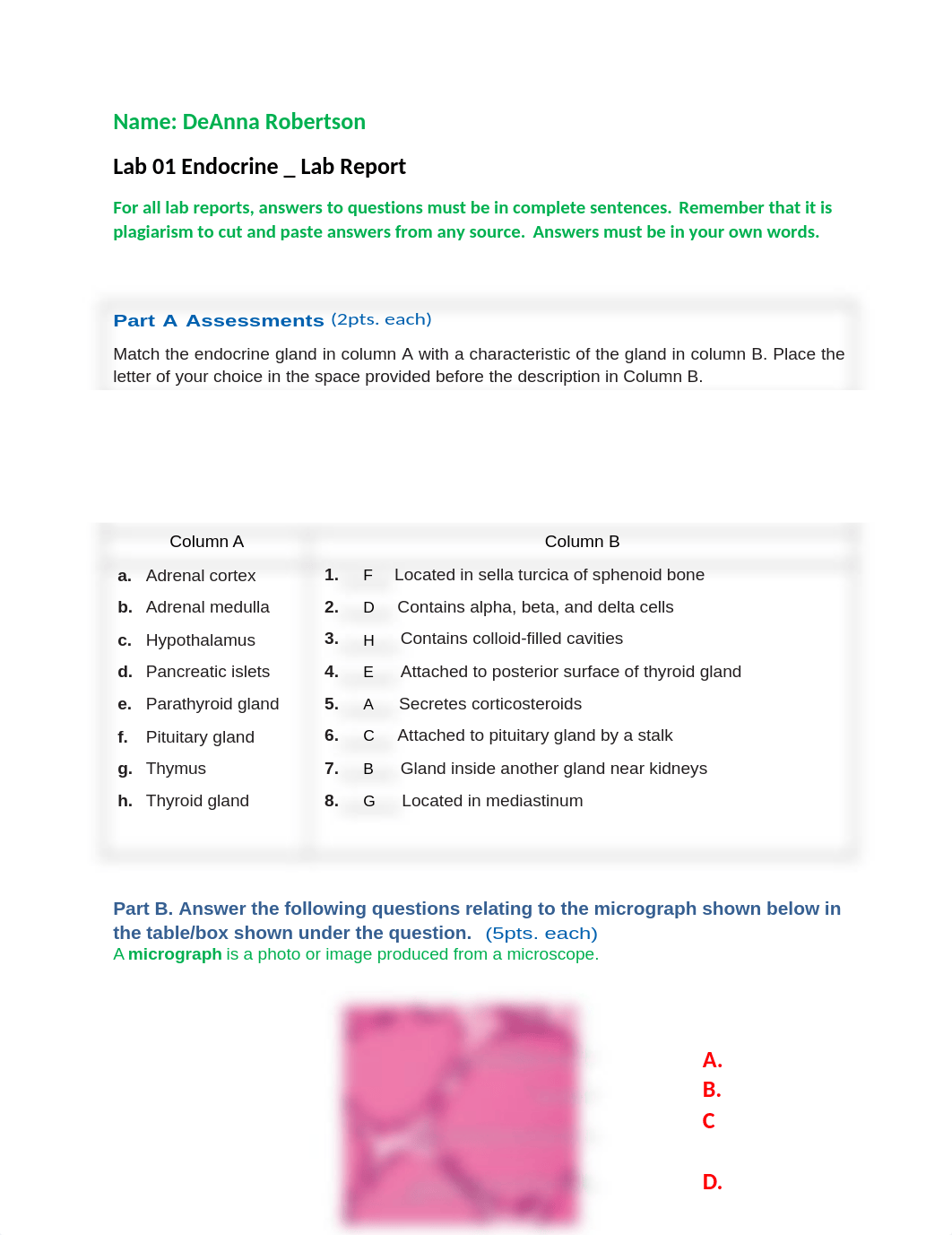 Chapter 13 Endocrine Lab_D Robertson.docx_d6466bzpp5o_page1