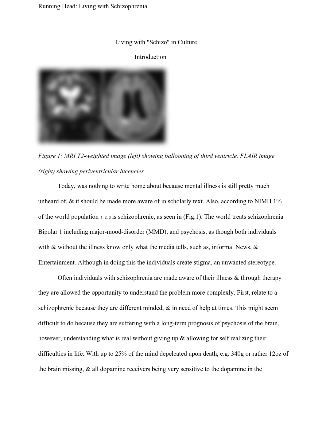 Living with Schizophrenia.pdf_d64wq5raeng_page3