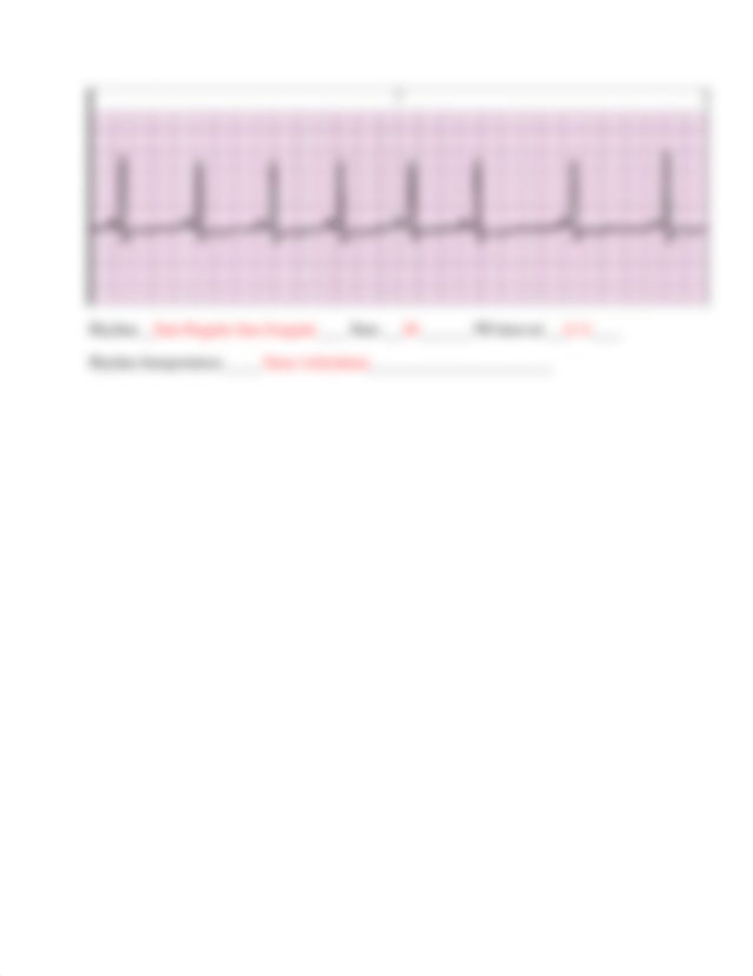 EKG Practice Strip Assignment- Student Copy.docx_d69kdt2xhpn_page4