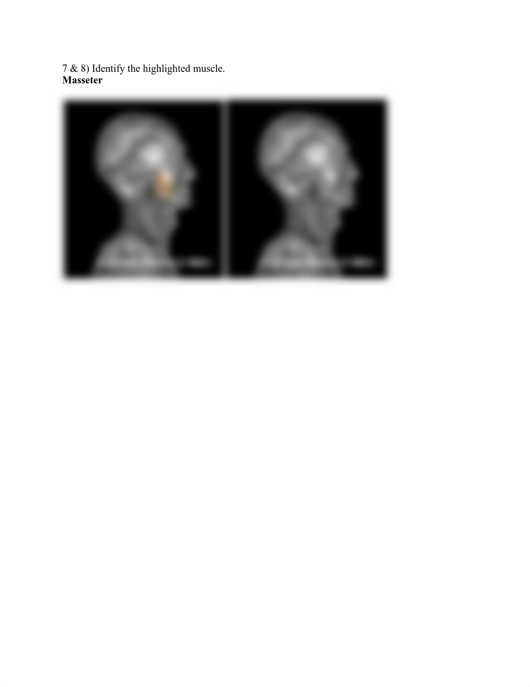 Muscles%20lab%20assignment.pdf.pdf_d6astiybvlo_page4