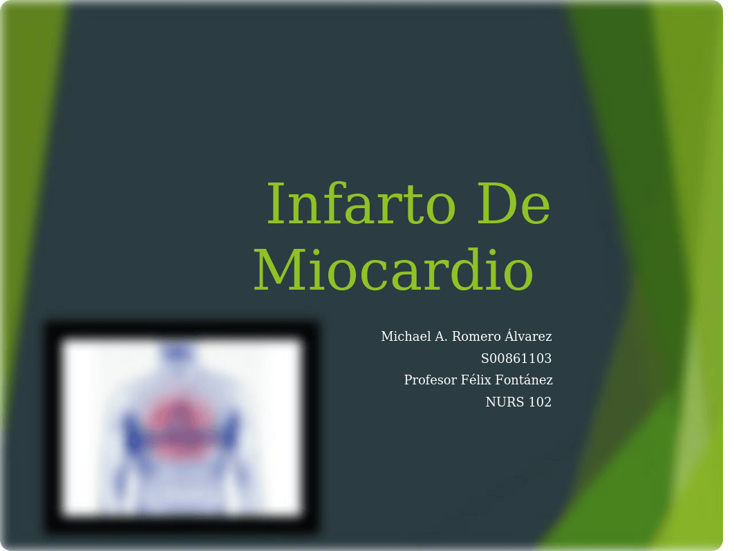 Infarto de Miocardio_d6dop1buyen_page1