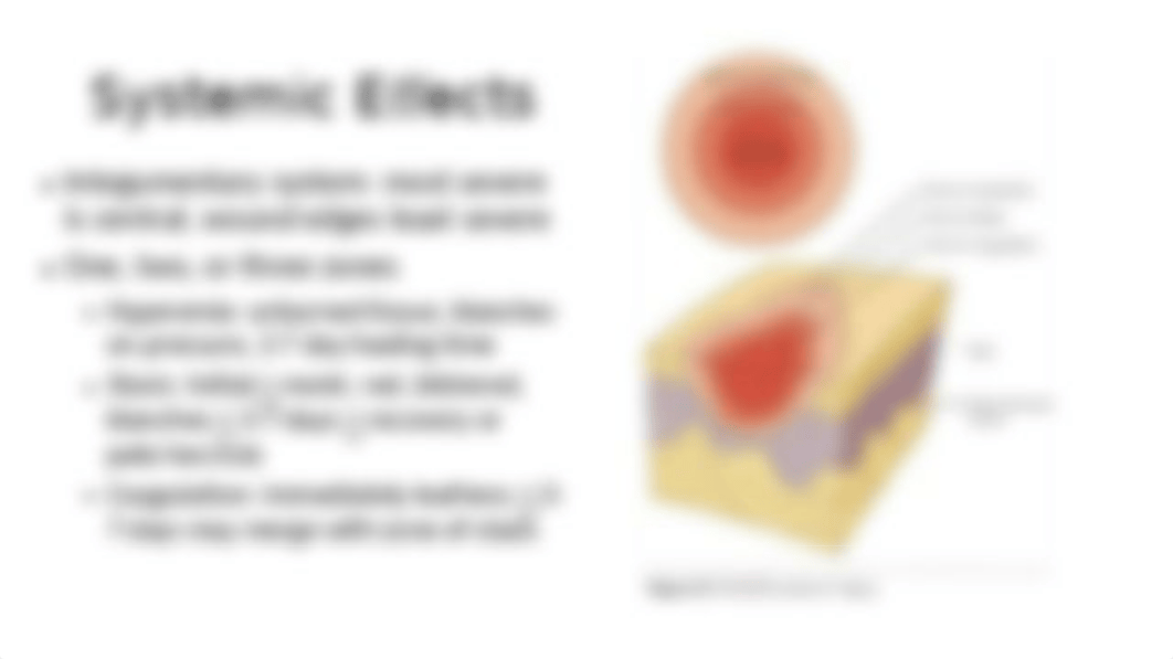 Pathophysiology of burns.pptm_d6fghh10wpy_page5