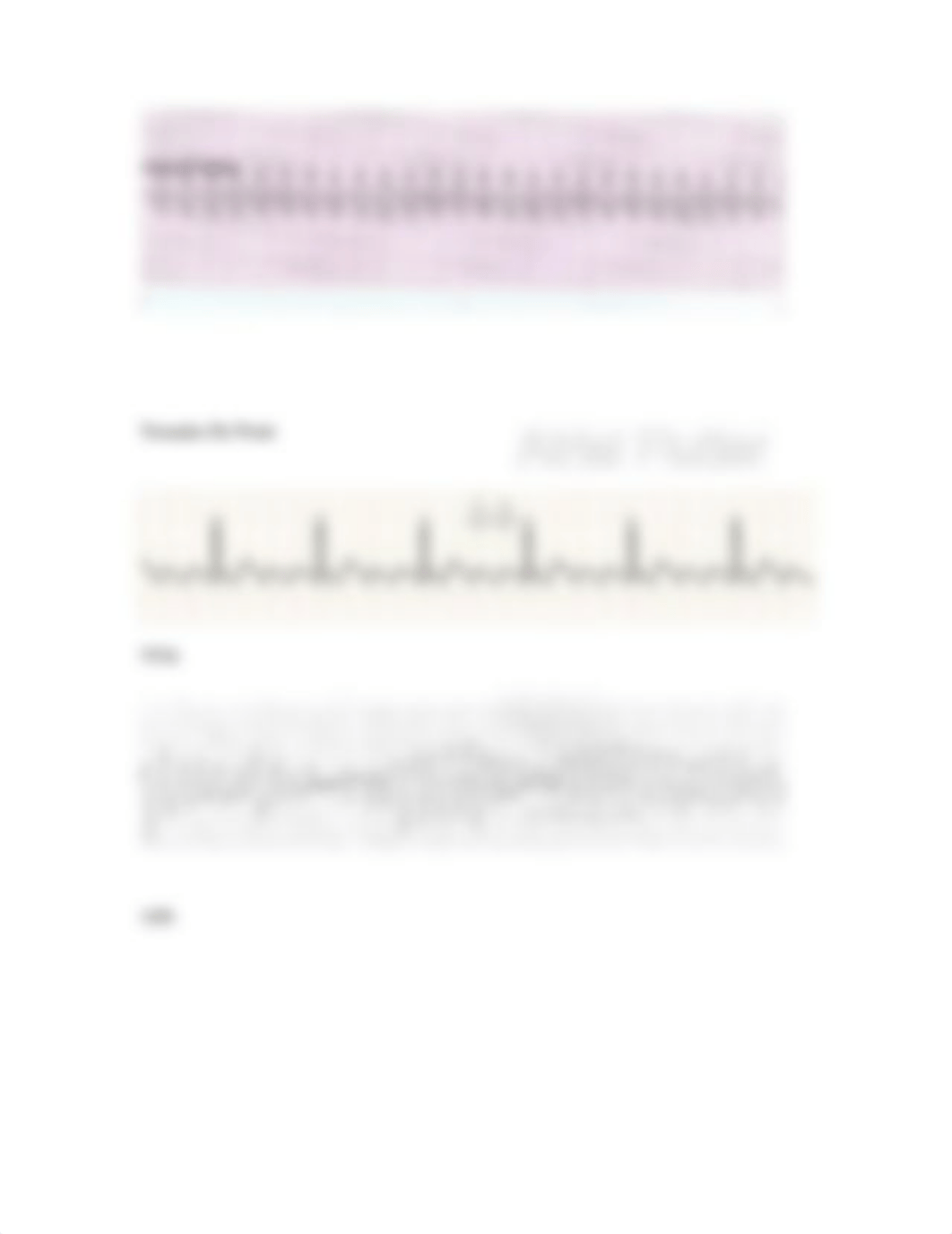 Heart Rhythm.docx_d6gq8p98rai_page3