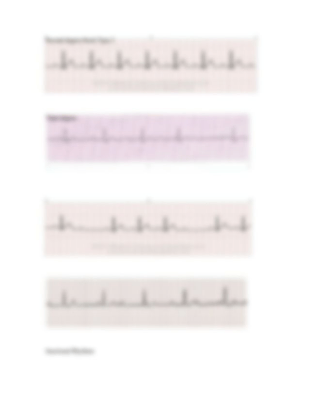 Heart Rhythm.docx_d6gq8p98rai_page5