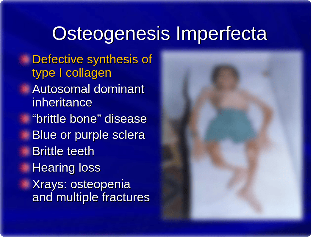 connective tissue disorders 1_d6grkp6wmgd_page4