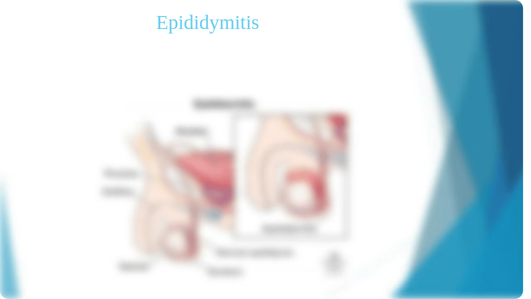 Epididymitis star.pptx_d6kgzizhdd8_page1