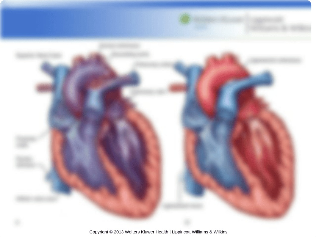 PPT_Chapter_17_d6nkjzm4g64_page4