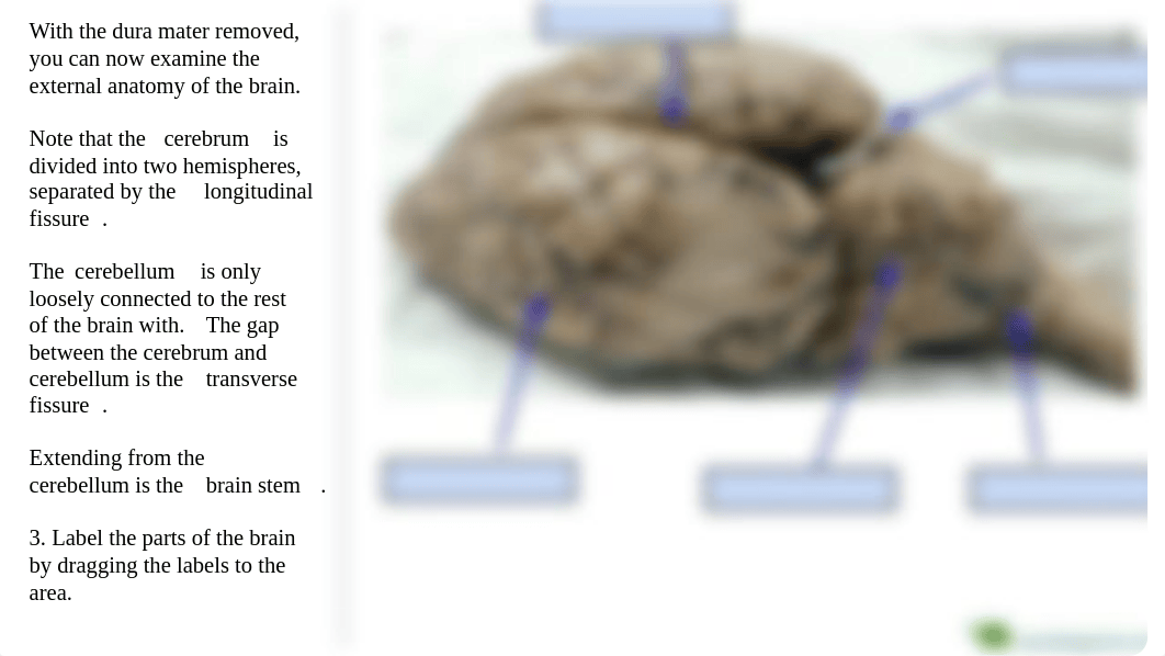 Copy of Copy of Brain Dissection - Guided Learning (1).pdf_d6swrqv8rk2_page4