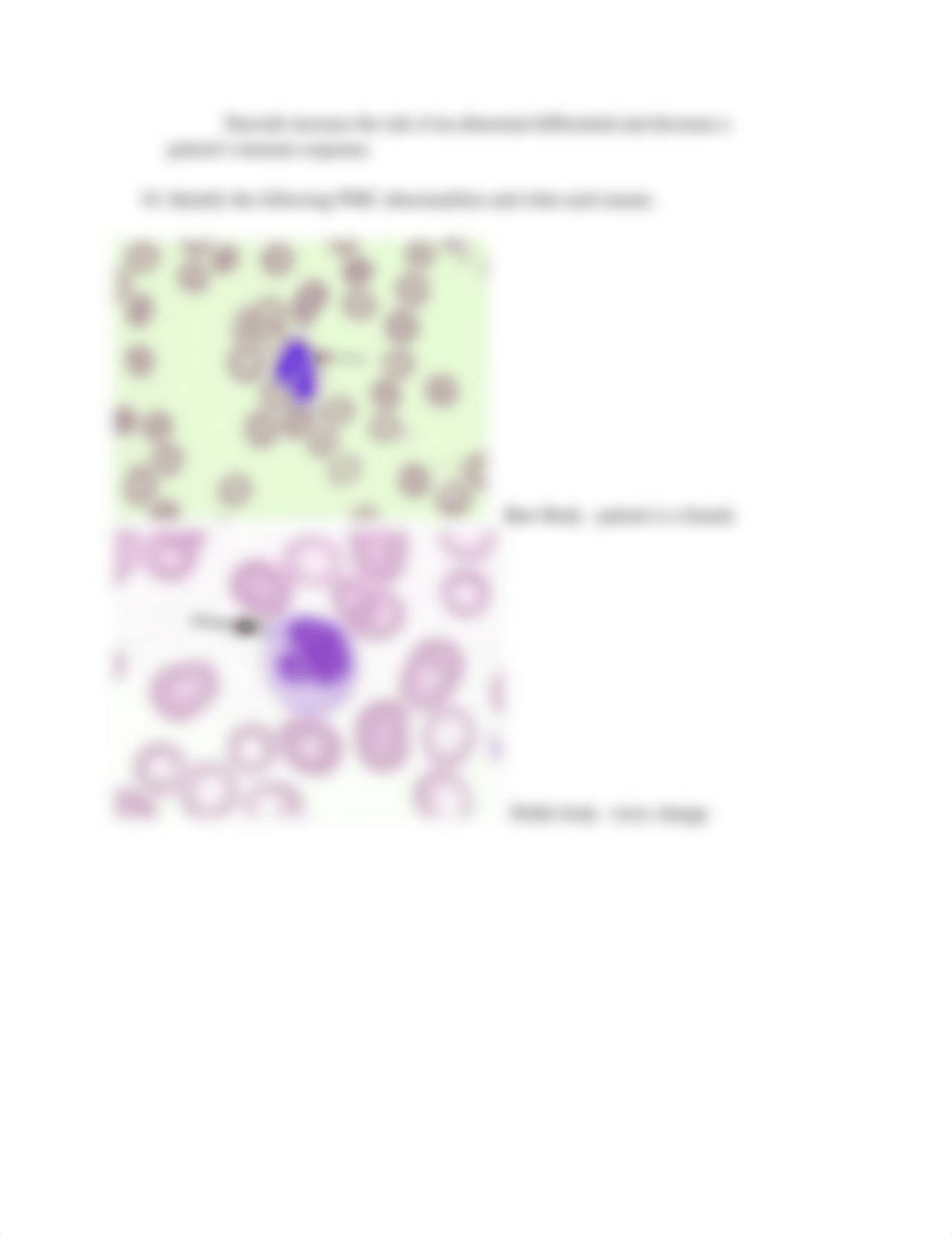 Assignment 10.2 WBC Differential Review (1).pdf_d6wfsfaimws_page5