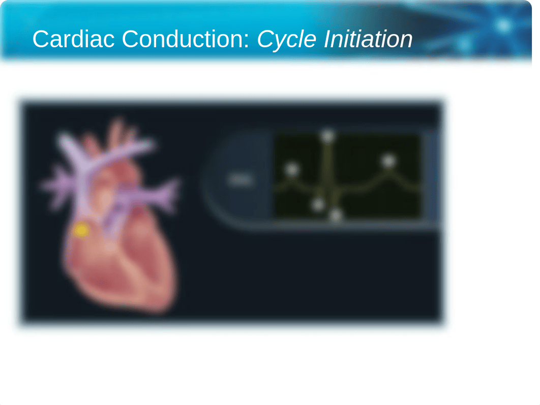 Heart-Rhythm-Interpretation-ECG-Strips-2012A-CC_d701b19456l_page5