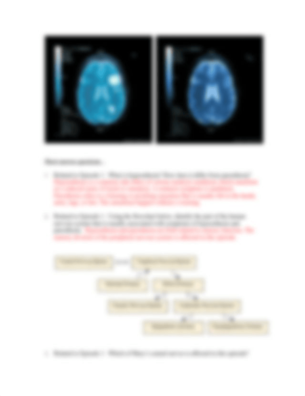 case study neuro (1).doc_d723mbe7386_page2