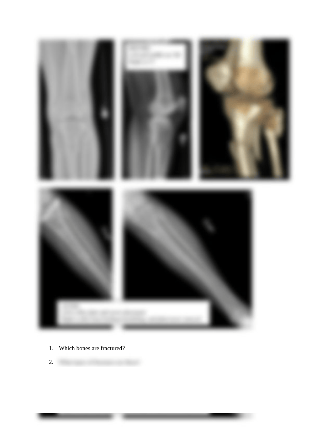 A&P1Case Study4Kati(1).docx_d727ov94xj1_page2