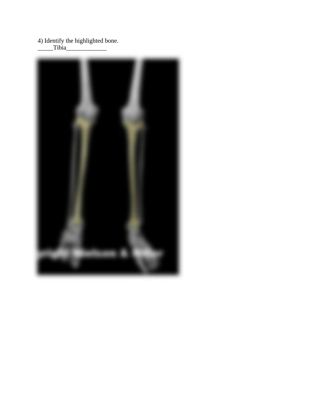 09_lower_limb_skeletal_anatomy_Worksheet (2).docx_d72nulxqnvy_page4