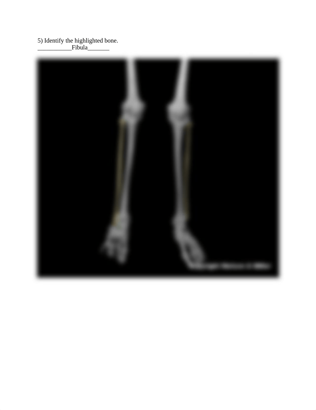 09_lower_limb_skeletal_anatomy_Worksheet (2).docx_d72nulxqnvy_page5