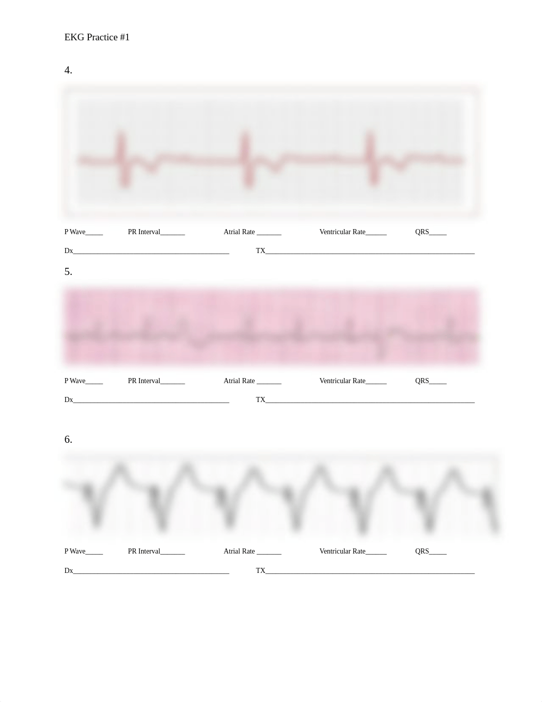 EKG Practice #1.docx_d72ycoz1bxc_page2