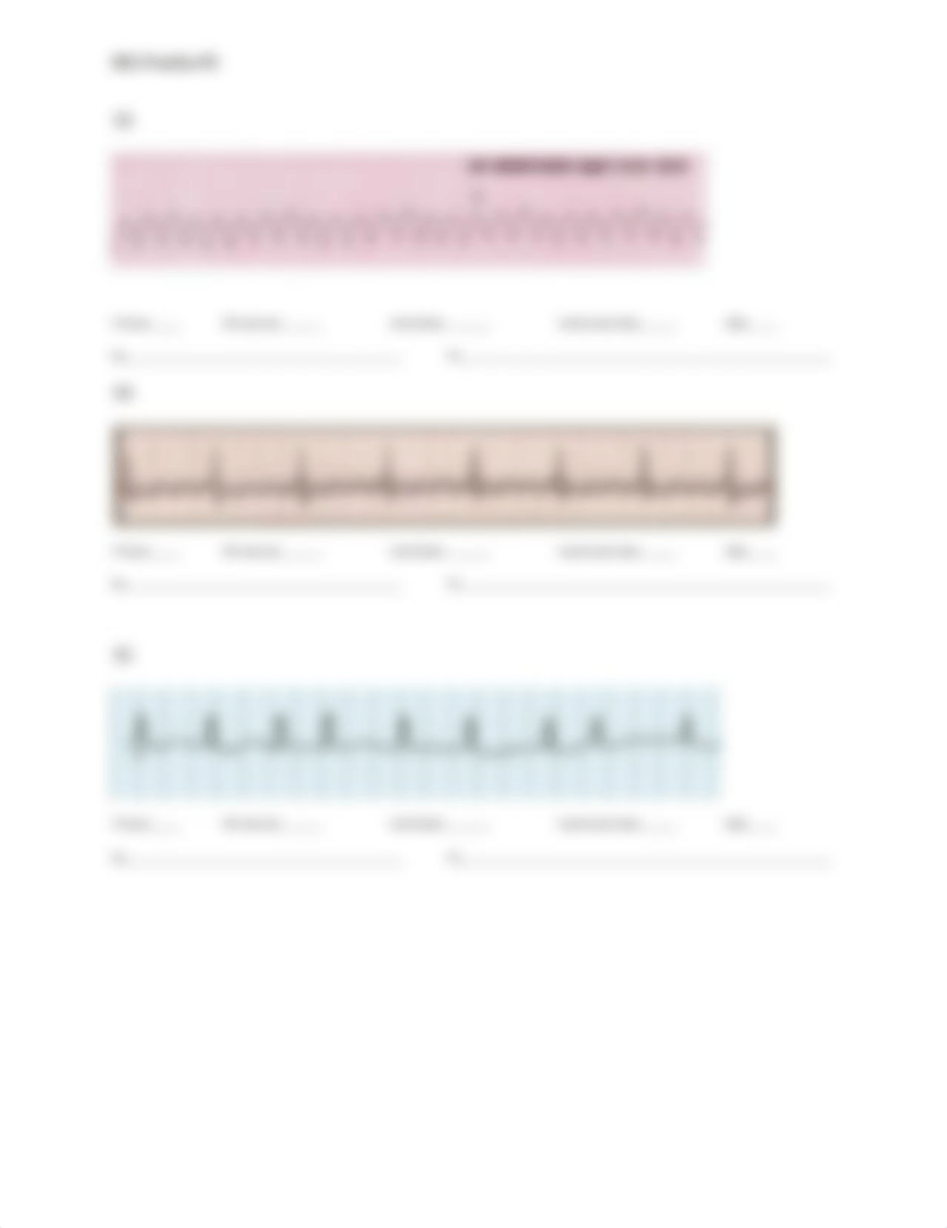 EKG Practice #1.docx_d72ycoz1bxc_page5