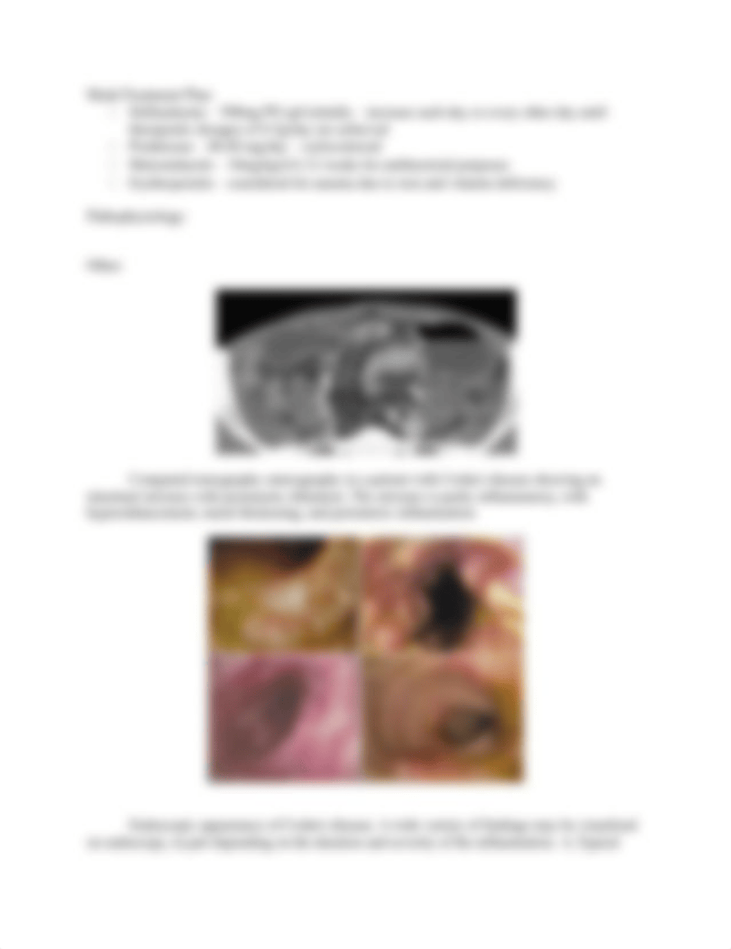 Crohn Disease_d73ac4tst0c_page2