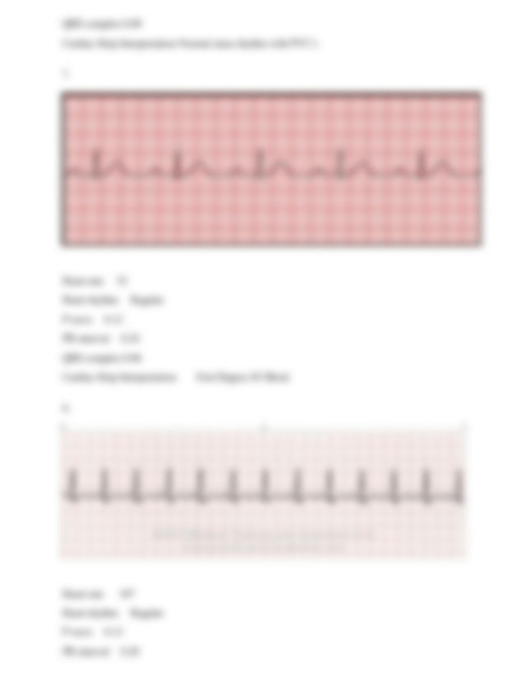 EKG Rhythm Practice .docx_d78q5btzmy4_page4