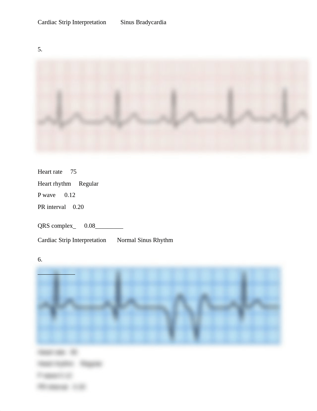 EKG Rhythm Practice .docx_d78q5btzmy4_page3